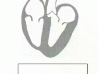 I cardiologi studiano gli effetti della musica sul cuore 19/06/2020)
